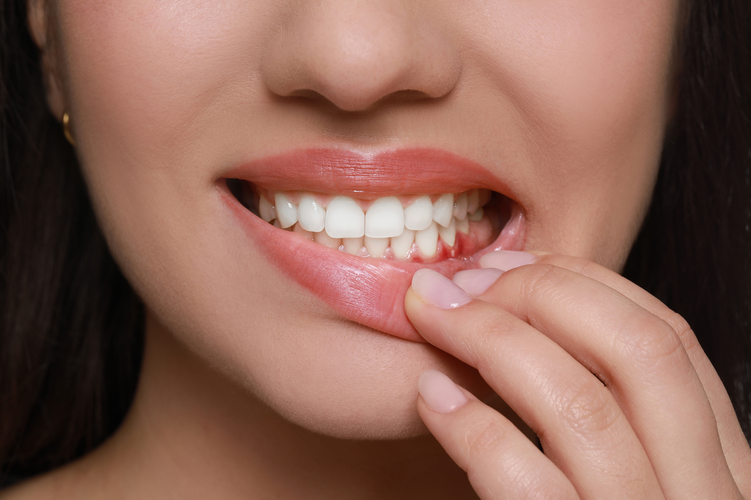 Periodontal (Gum) Disease Causes, Symptoms and Treatments